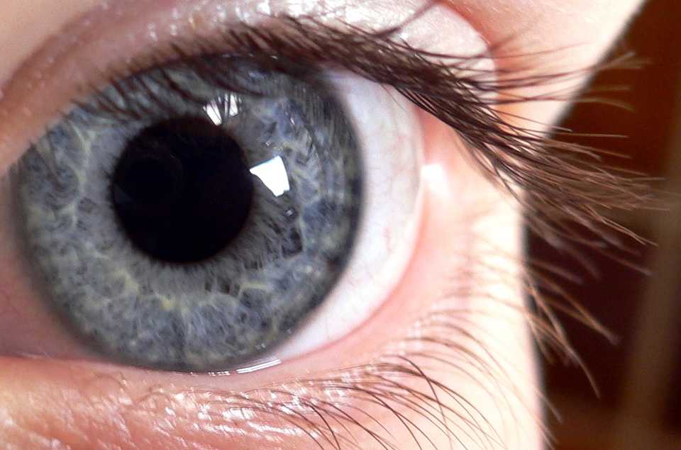 Can Eye Color Be Changed With Surgery?