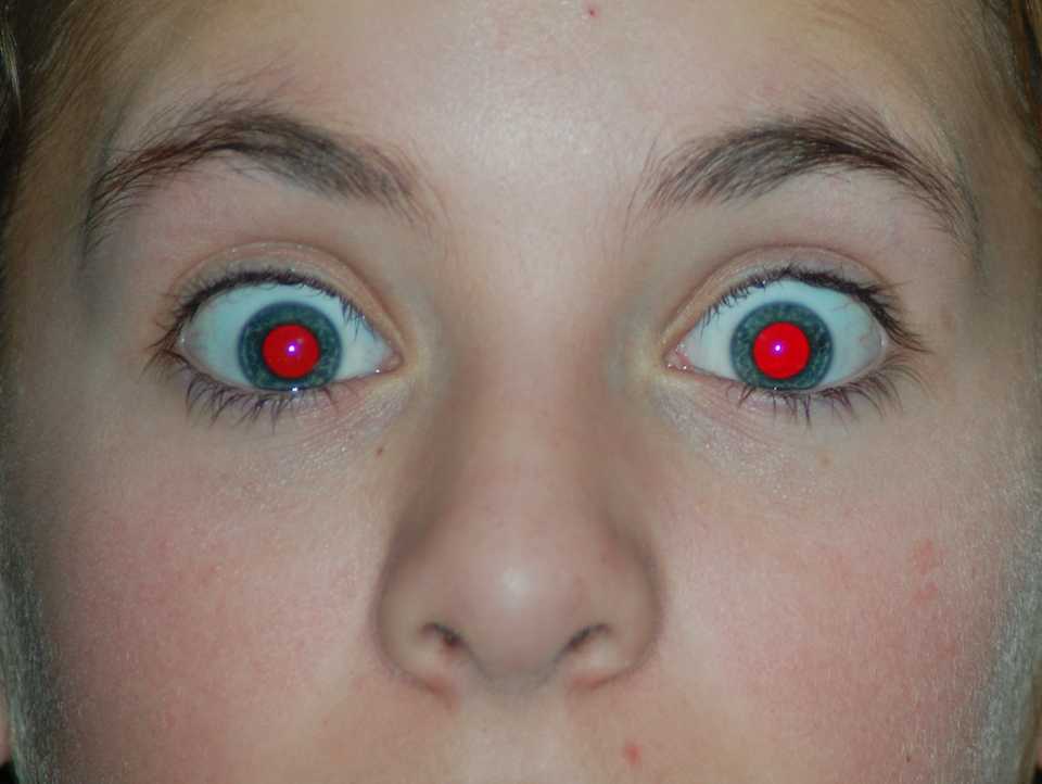 What Causes Bright Red Eyes In Photos?