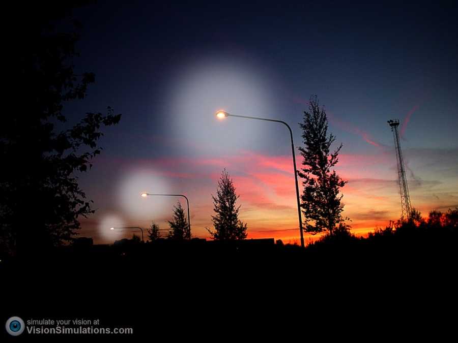 What Are Halos And Starbursts? Barrett Eubanks, M.D.