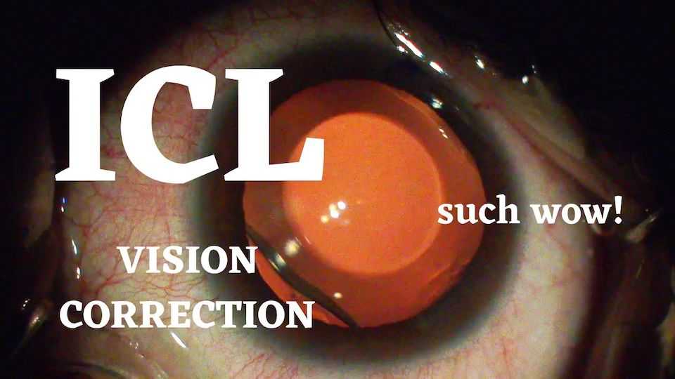 Watch How ICL is Done